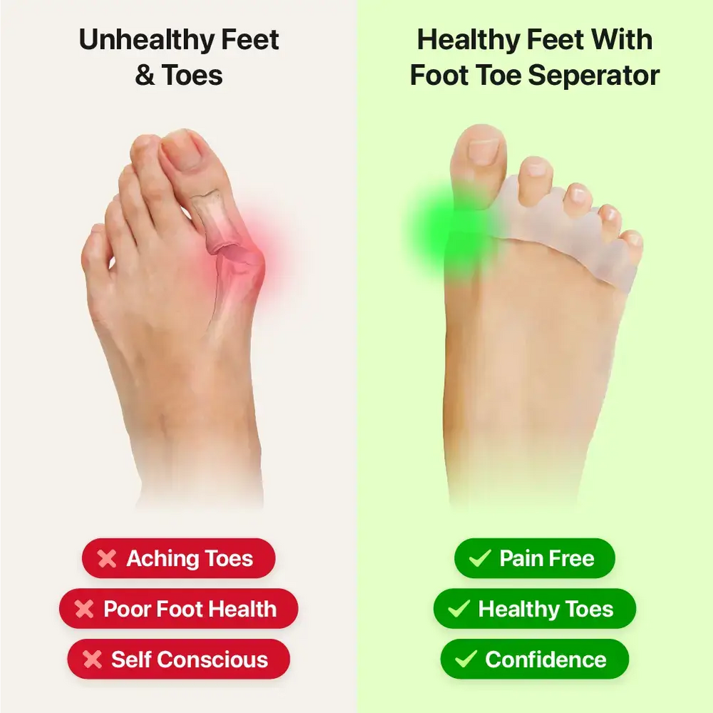 Foot Toe Separator - Achieve Healthy Toes, Correct Bunions, Hammer Toes, and Relieve Foot Pain